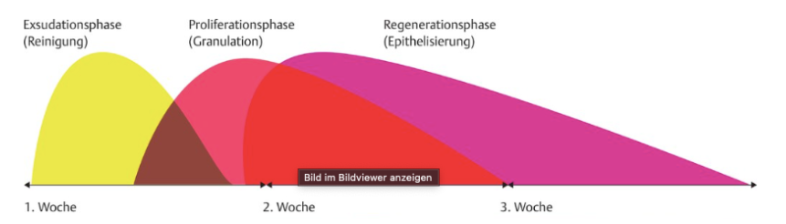 pflegewiki_wundheilung1.png